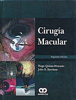 ISBN: 9789588760643 CIRUGIA MACULAR
