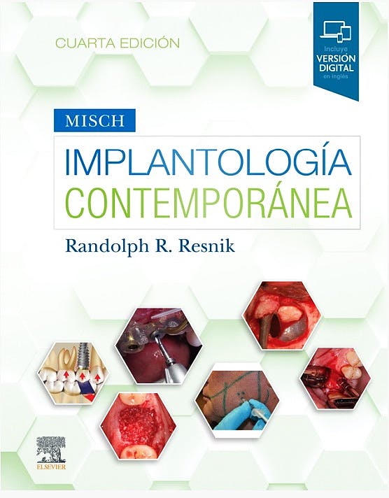 ISBN: 9788491135494 MISCH IMPLANTOLOGIA CONTEMPORANEA