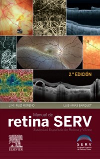 ISBN: 9788491135647 MANUAL DE RETINA SERV