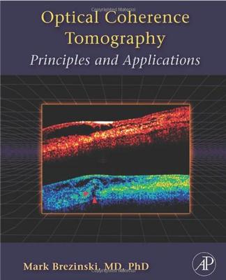 ISBN: 9780121335700 OPTICAL COHERENCE TOMOGRAPHY