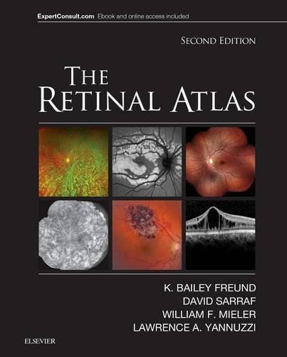 ISBN: 9780323287920 THE RETINAL ATLAS