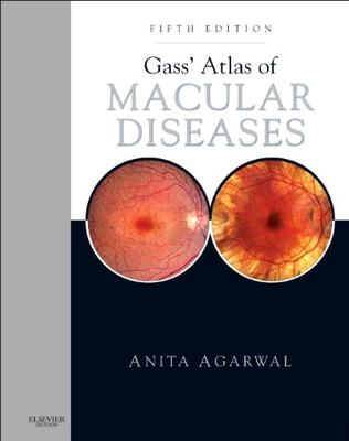 ISBN: 9781437715804 GASS' ATLAS OF MACULAR DISEASES