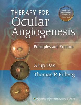 ISBN: 9781605476407 THERAPY FOR OCULAR ANGIOGENESIS