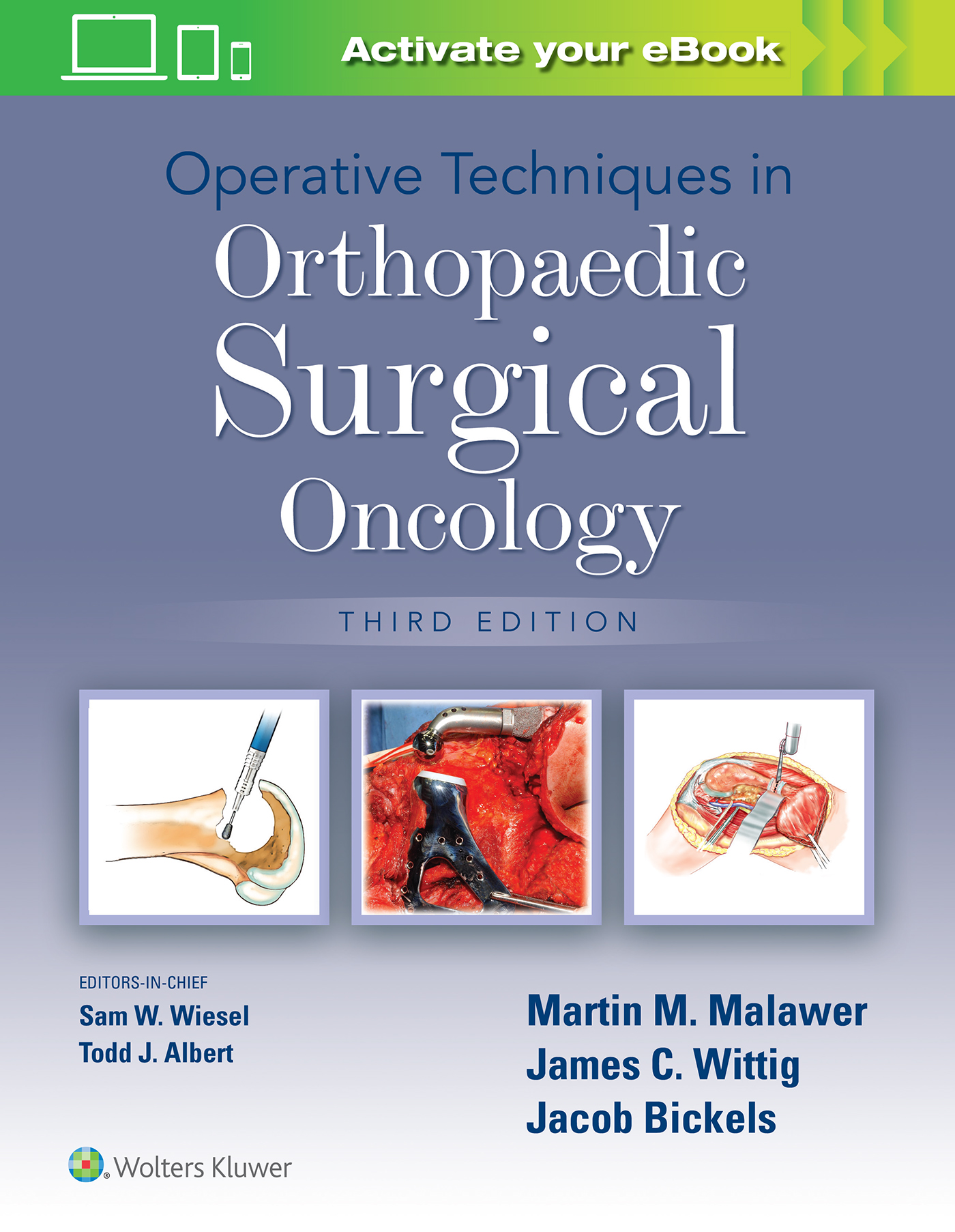 9781975172084 ::  OPERATIVE TECHNIQUES IN ORTHOPAEDIC SURGICAL ONCOLOGY 