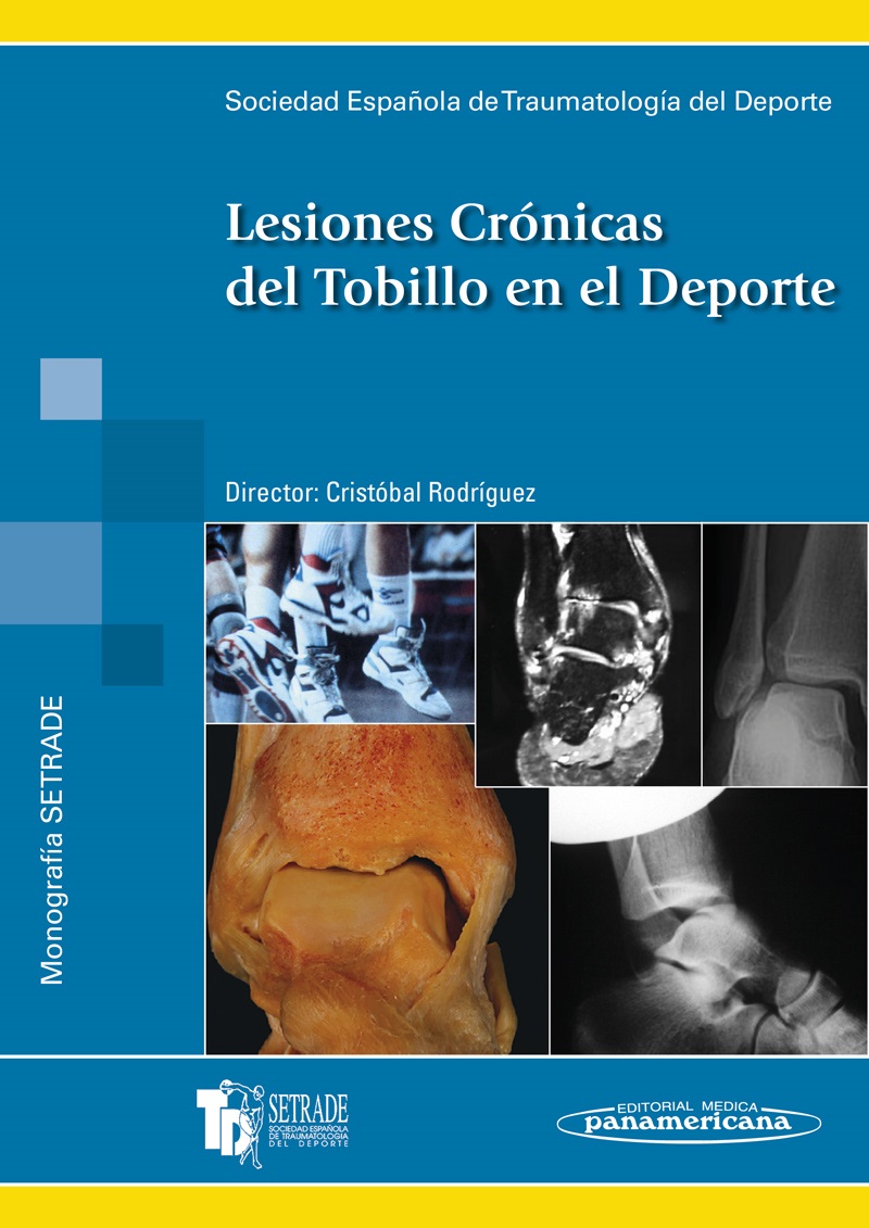 ISBN: 9788479037925 LESIONES CRÓNICAS DEL TOBILLO EN EL DEPORTE