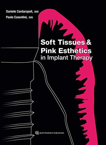 ISBN: 9780867158151 SOFT TISSUES AND PINK ESTHETICS IN IMPLANT THERAPY