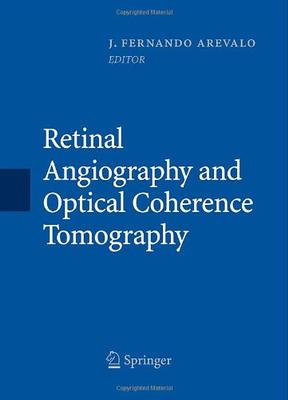 ISBN: 9780387689869 RETINAL ANGIOGRAPHY AND OPTICAL COHERENCE TOMOGRAPHY