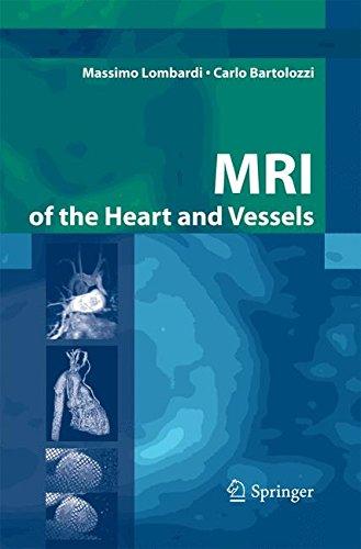 9788847055469 ::  MRI OF THE HEART AND VESSELS 