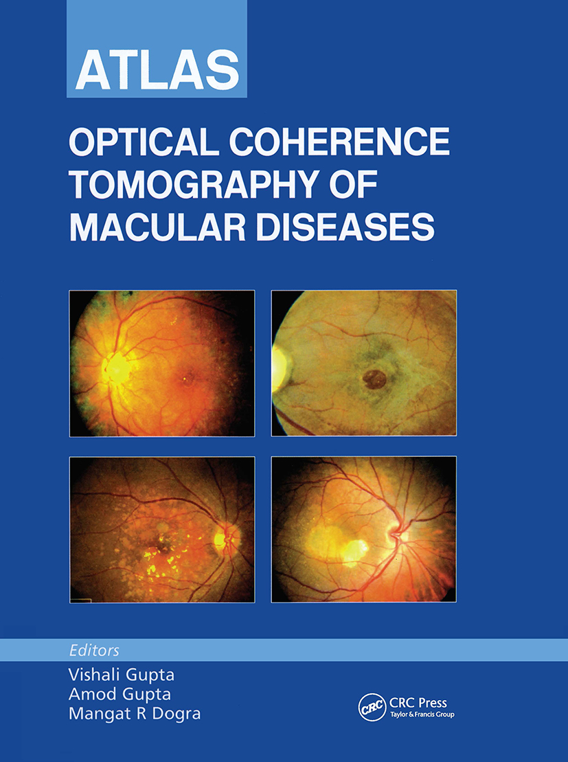 9781841844688 ::  ATLAS OF OPTICAL COHERENCE TOMOGRAPHY OF MACULAR DISEASES DISEASES