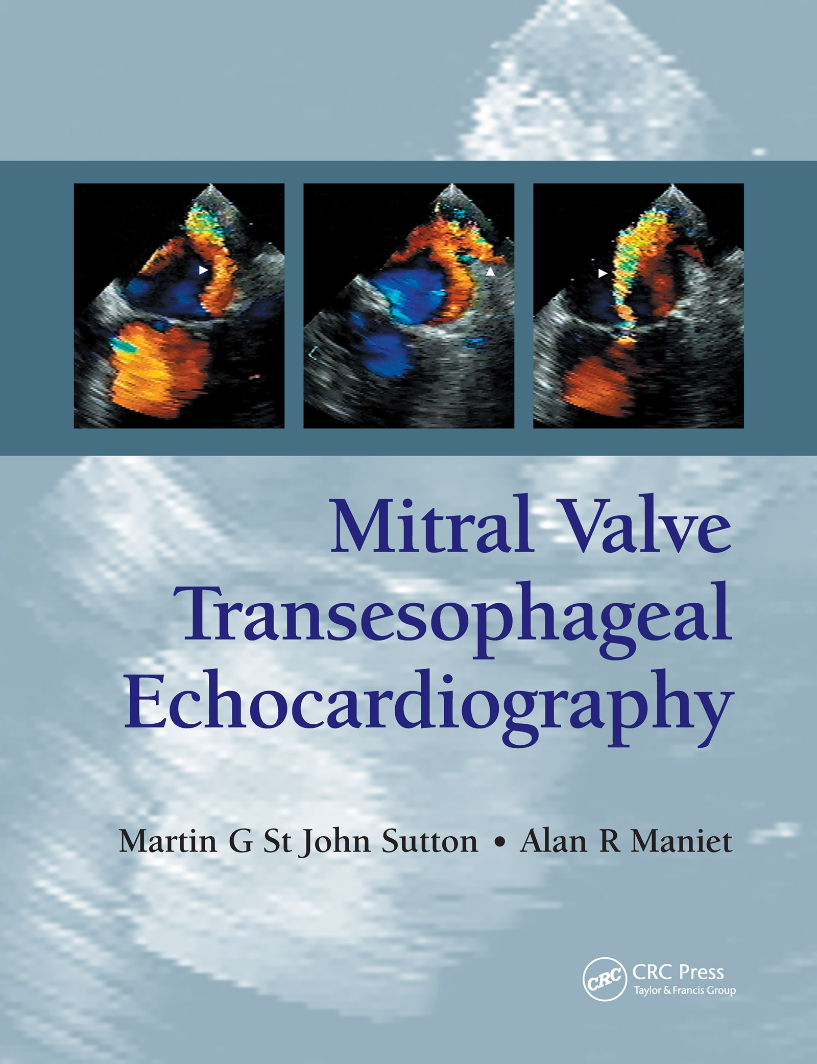 ISBN: 9781841846088 MITRAL VALVE TRANSESOPHAGEAL ECHOCARDIOGRAPHY