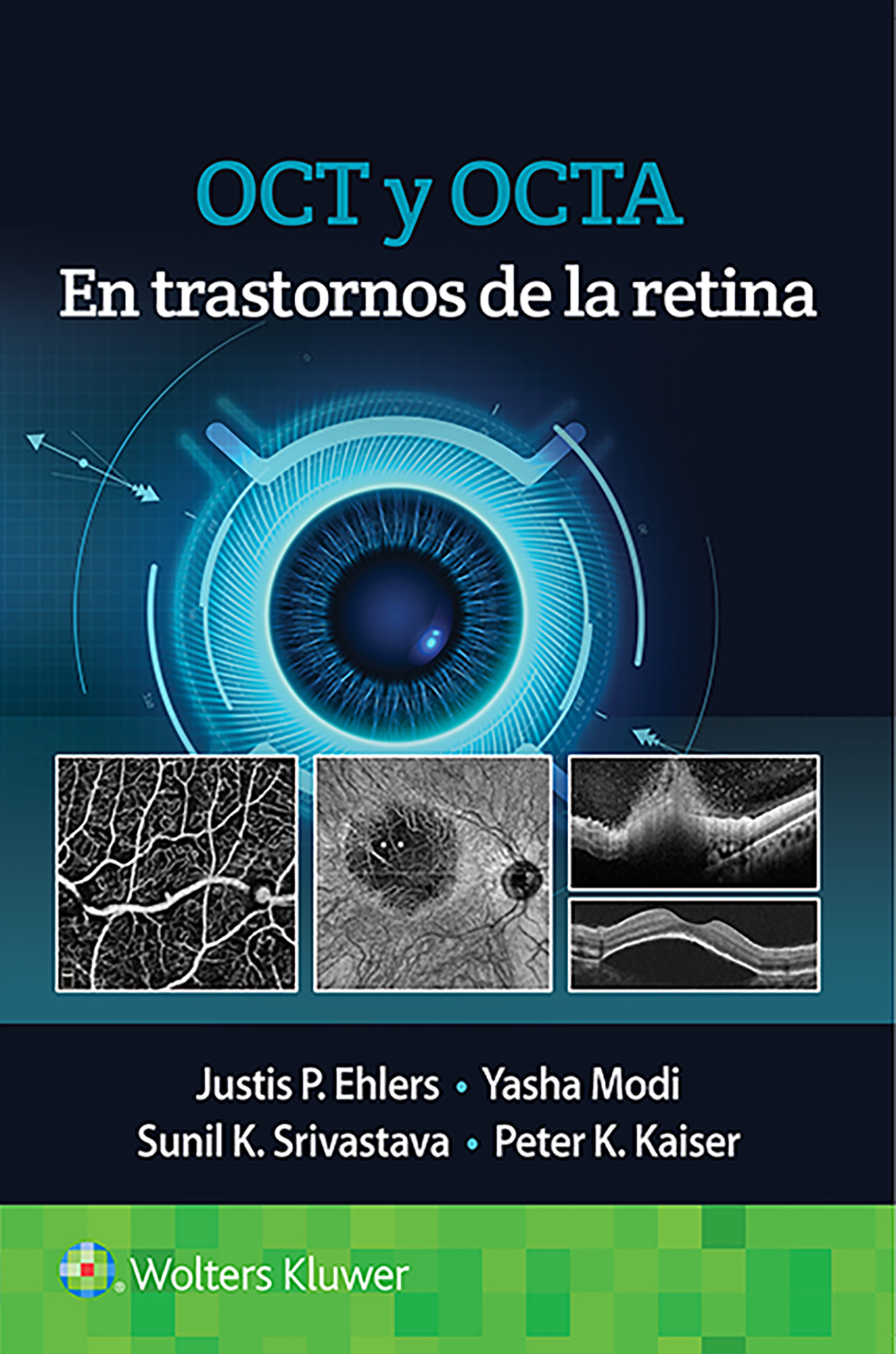 ISBN: 9788418563126 OCT Y OCTA EN TRASTORNOS DE LA RETINA
